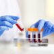 Woman working with blood samples in laboratory, closeup